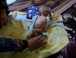 Kondisi Bayi Memprihatinkan di Desa Tang Buol